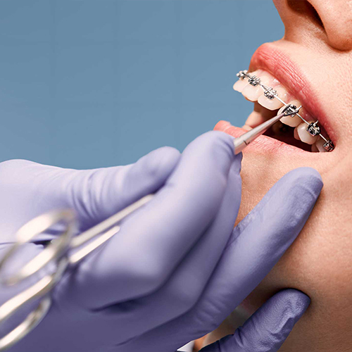 Dentist examining a young patient's smile