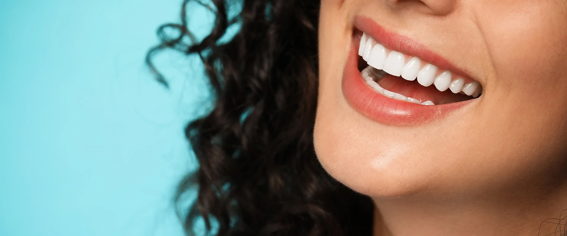 Veneers Dentist Near Sion