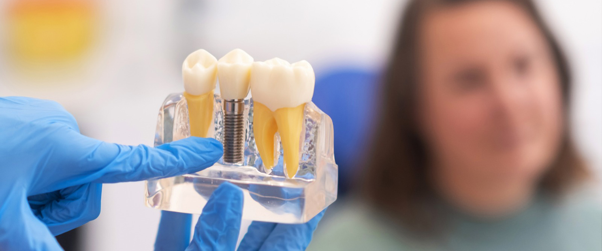 Dental Implant In Sion
