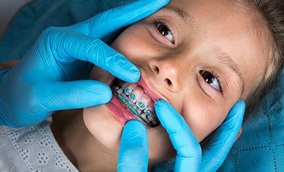 Preventive and Interceptive Orthodontics