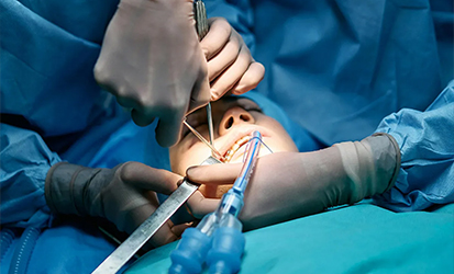 Dental Treatment Under General Anesthesia